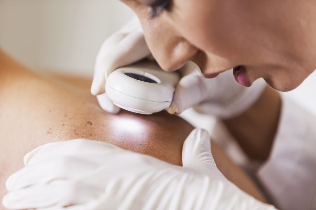 What You Should Know About Skin Cancer