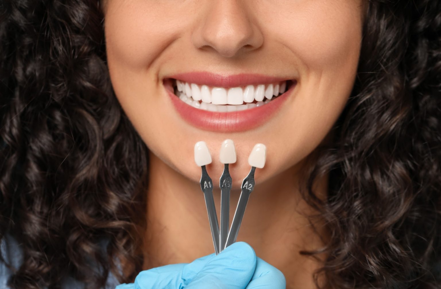 How To Care for Your Veneers