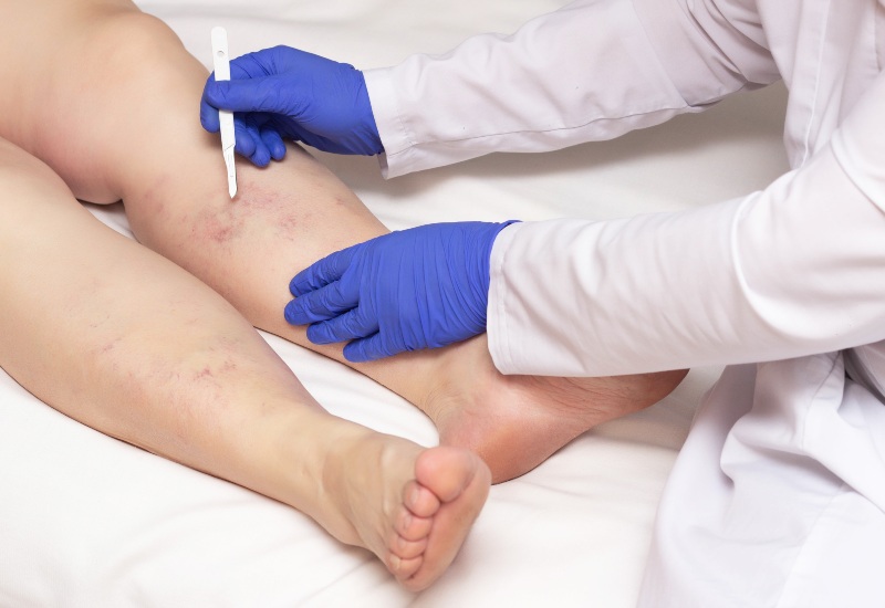 What To Expect During a Consultation with a Vascular Surgeon Consultation with a Vascular Surgeon