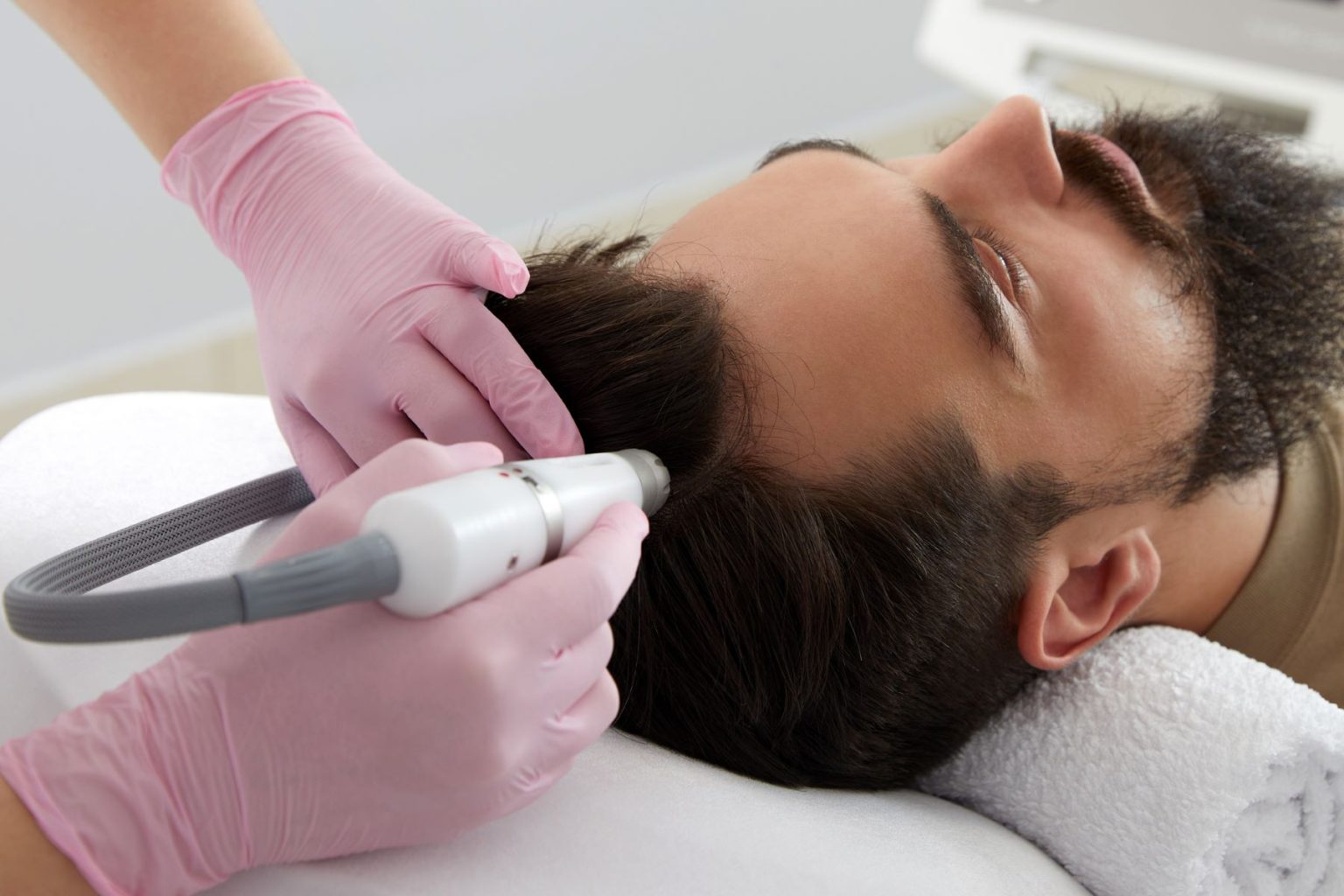 Hair Replacement Options for Thinning Hair
