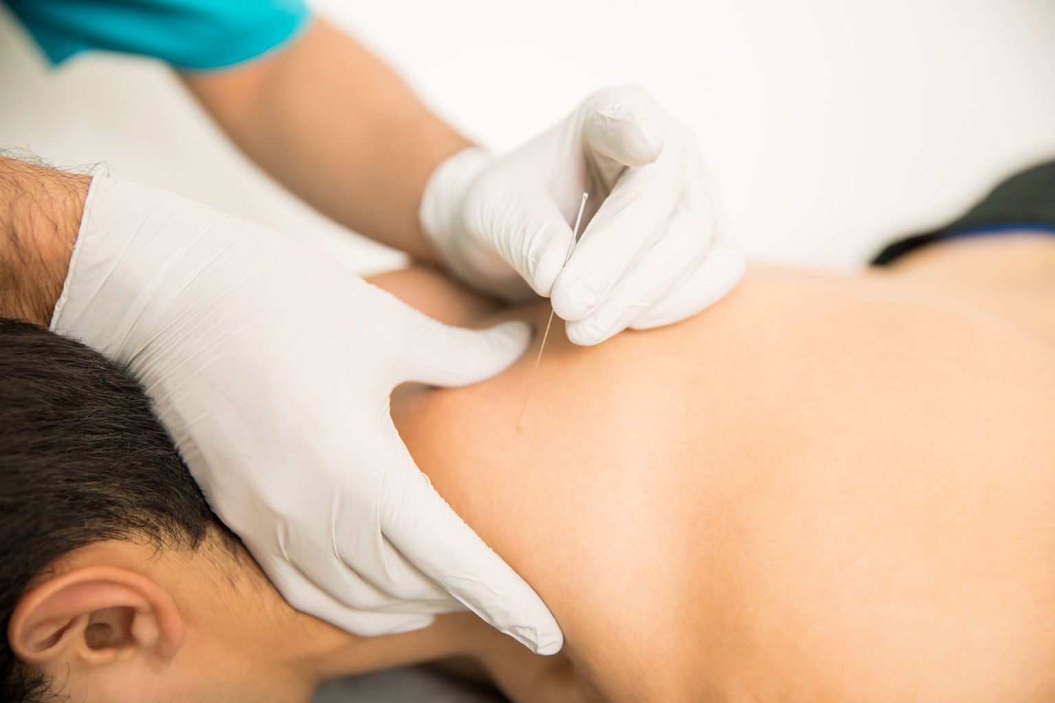 Acupuncturist