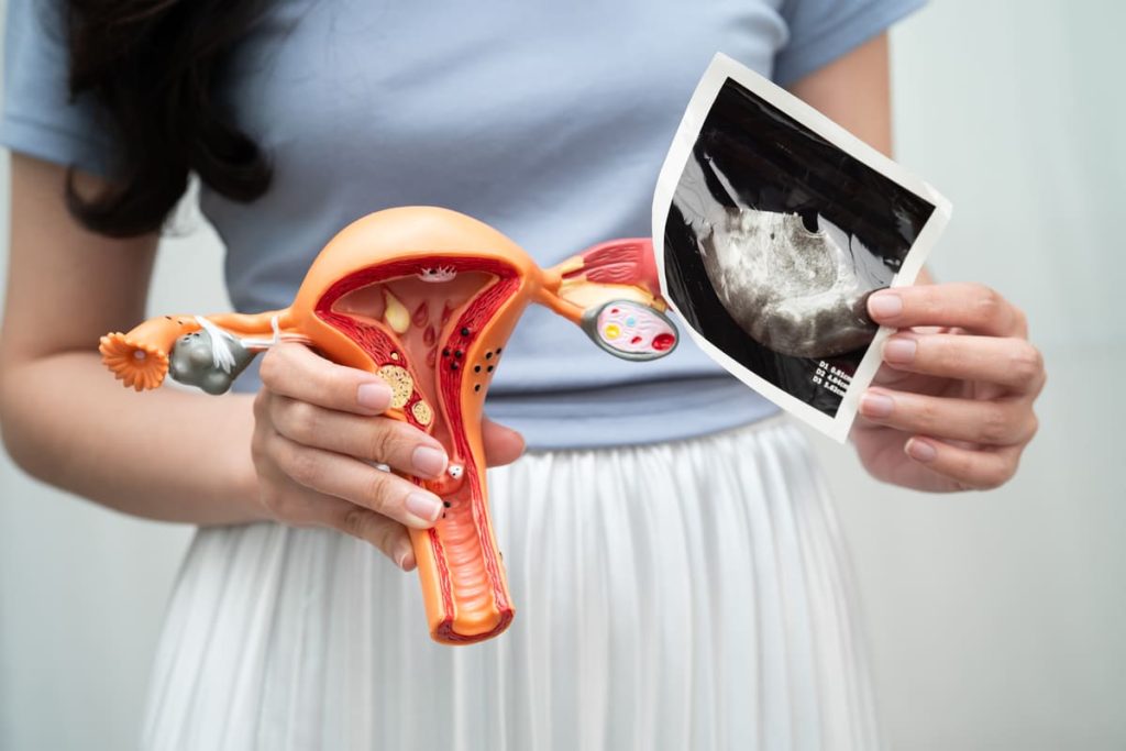 Fibroids During Pregnancy