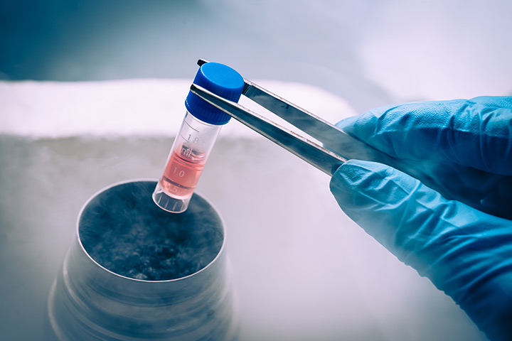 What to Expect During a Frozen Embryo Transfer in IVF Frozen Embryo Transfer in IVF
