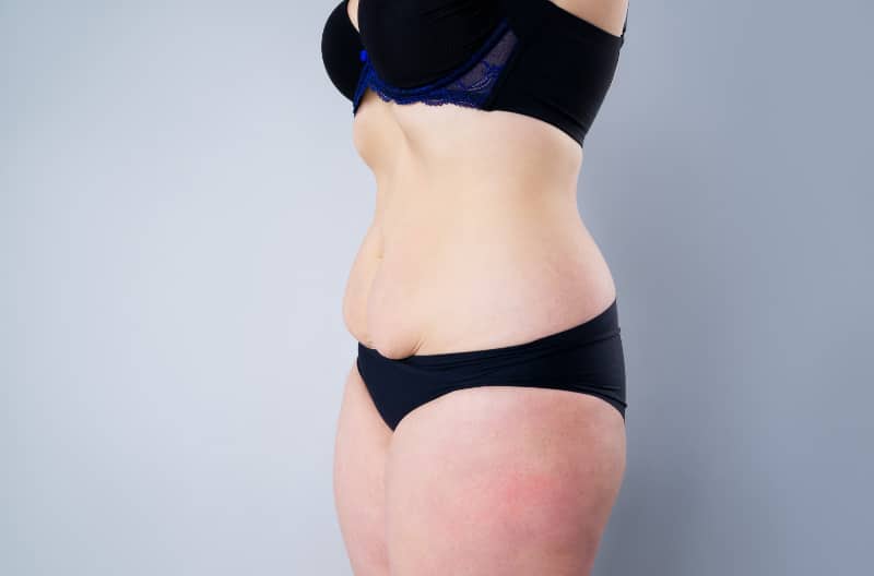 Tips To Improve Your Liposuction Results Improve Your Liposuction Results