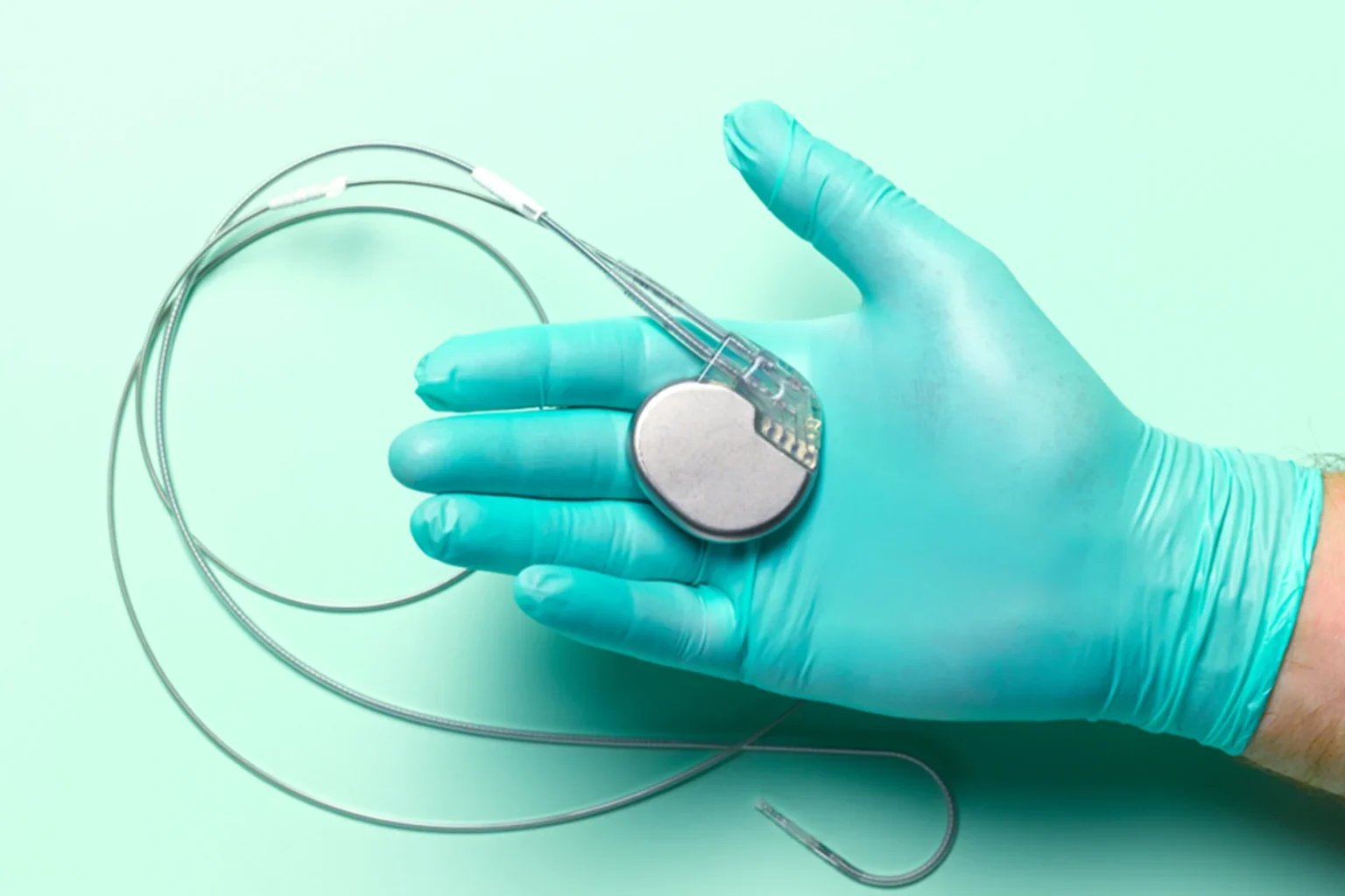 Pacemaker Insertion Procedure