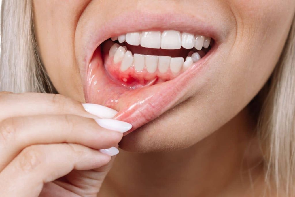 Role of Periodontics in Preventing Gum Disease