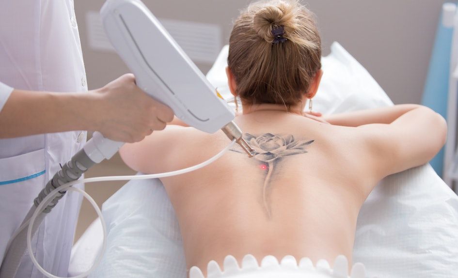 What To Look for in a Tattoo Removal Specialist Tattoo Removal Specialist