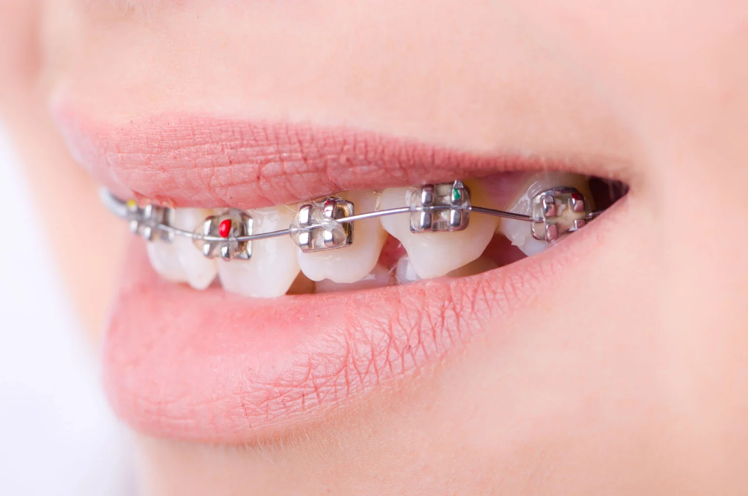 Orthodontist